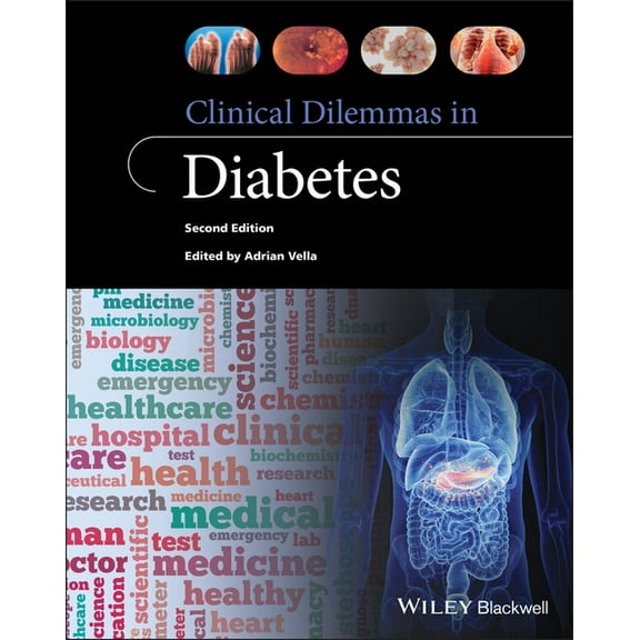 Clinical Dilemmas (UK) Clinical Dilemmas in Diabetes, (Paperback)
