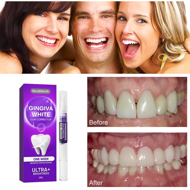 Lápiz blanqueador dental rotatorio, blanqueador dental, lápiz blanqueador dental de 3 ml, lápiz limpiador dental