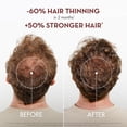 thumbnail image 4 of Klorane Strengthening Shampoo with Quinine and Edelweiss - Reduce Hair Thinning & Breakage - Strengthens & Revitalizes, 13.5 fl oz, 4 of 9