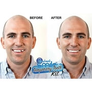 Complete Denture Repair Kit