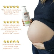 Palmers Cocoa Butter Formula For Stretch Marks Lotion, 8.5 fl oz