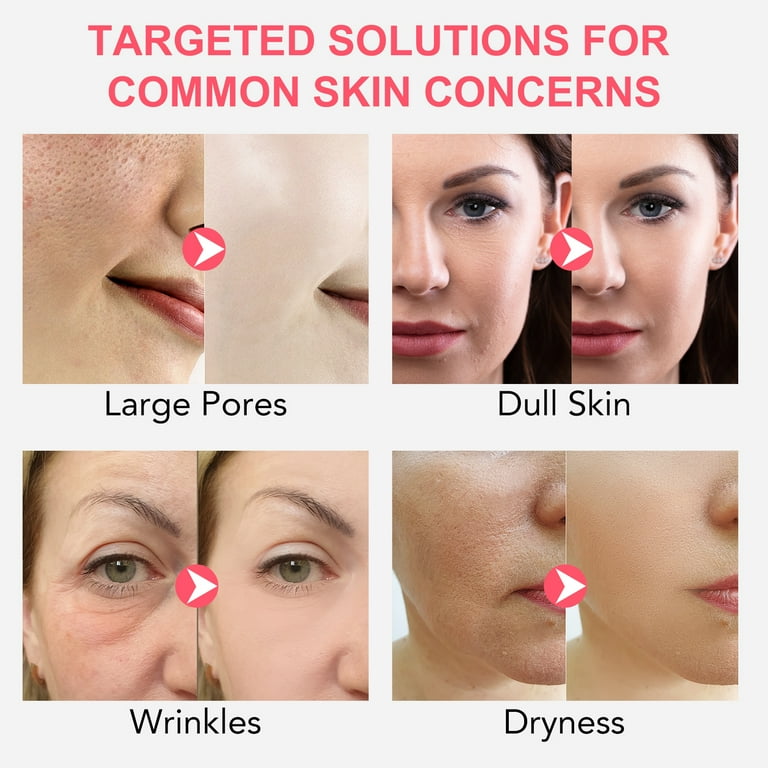 Ikzee Bio Collagen Deep Hydration Mask,Anti-Aging Hydrating Face Mask for Moisturize, Firm & Enhance Skin Vitality(4 Pcs) Ikzee Bio Collagen Deep Hydration Mask,Anti-Aging Hydrating Face Mask for Moisturize, Firm & Enhance Skin Vitality(4 Pcs)
