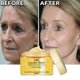 thumbnail image 2 of Crema reafirmante antiedad para el cuidado de la piel, crema Facial para eliminar arrugas, líneas finas, blanqueamiento, brillo, oro de 24 quilates Fivean unisex, 2 of 2