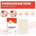 thumbnail image 4 of Parche hidrocoloide para acné y espinillas HUOGUO para el tratamiento de las espinillas, 4 of 5