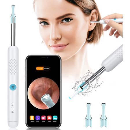 endoscope for ear wax