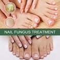 DIY nail care tricks Nail care for brittle nails Nail care routine