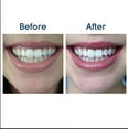 Opalescence Go Prefilled Teeth Whitening Trays 15 Hydrogen Peroxide Made by Ultradent