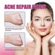 thumbnail image 3 of Mascarilla reparadora para el acné Jaysuing 10 unidades, 3 of 5