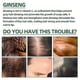 thumbnail image 4 of 1-3 piezas de aceite para el crecimiento del cabello Ouhoe, crecimiento rápido del cabello, reparación eficaz de la calvicie, pérdida de cabello hereditaria KR | | 1 pieza, 4 of 5