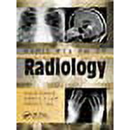 UPC: 9781840761207 | Rapid Review of Radiology