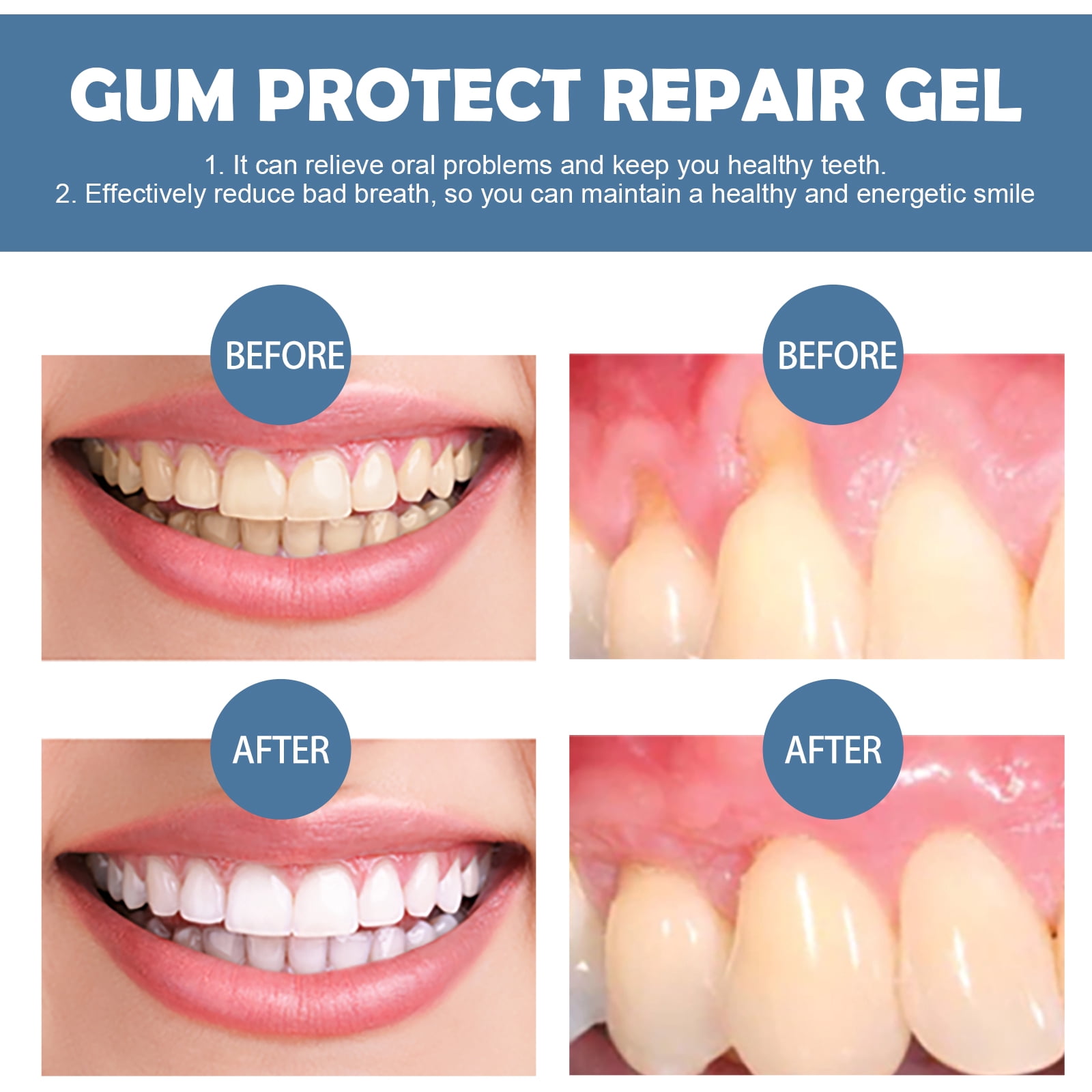 Alvantor Gum Repair Gel for Receding Gums, Teeth Whitening Essence Pen, Deep Cleaning Oral Care Fresh Breath, 3PCS
