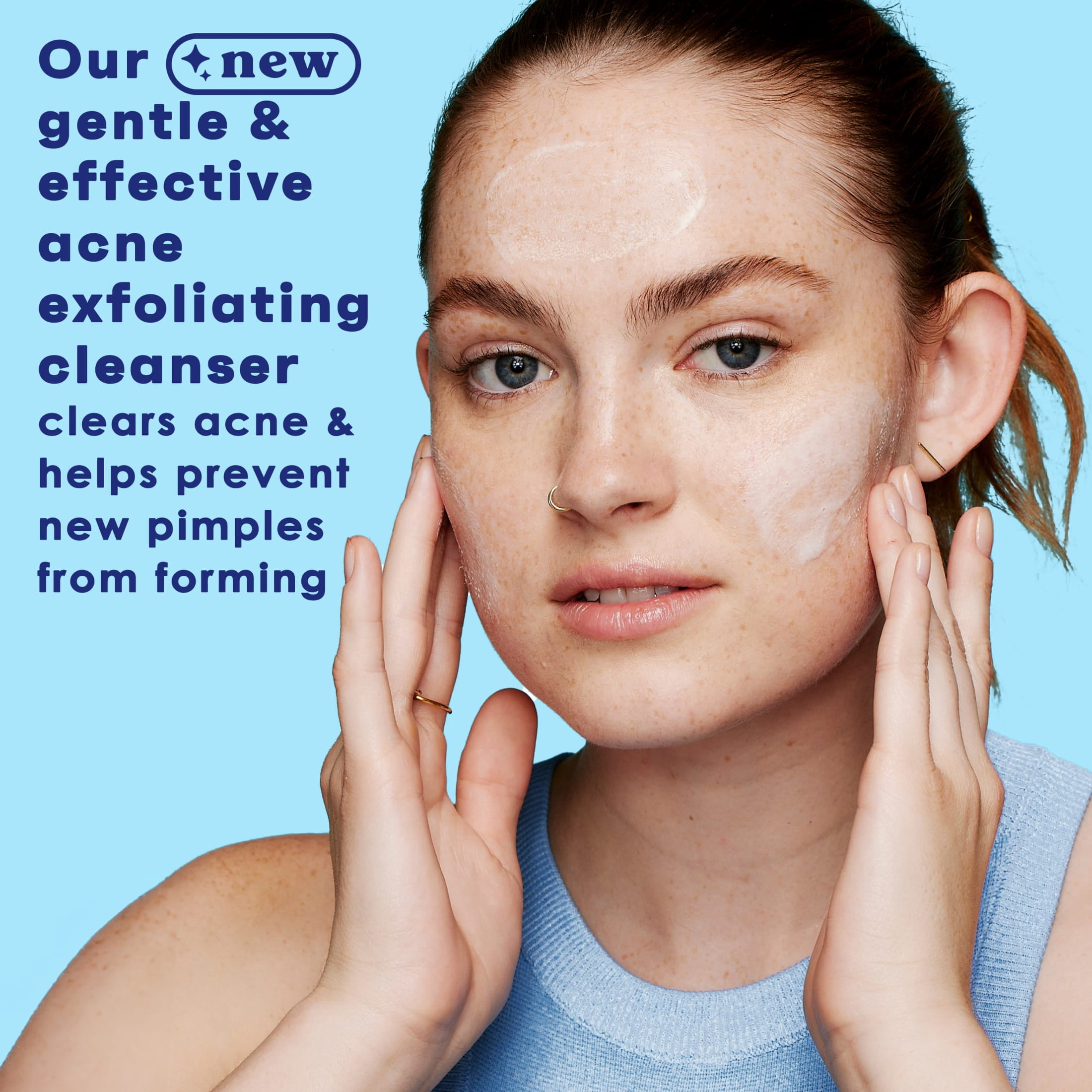 (3 pack) Clean & Clear Acne Triple Clear Exfoliating Facial Scrub, 5 oz