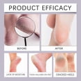 thumbnail image 4 of Foot Care Solution for Smoothing Calluses and Dead Skin, 4 of 5