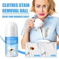 thumbnail image 1 of Stain Remover for Clothes, 1 of 5