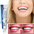 thumbnail image 1 of Hot6sl Liquidación de Ahorros de Verano Pasta de Dientes Probiótica para Reparar Caries, Eliminar Manchas y Blanquear Los Dientes, 1 of 7