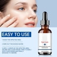 thumbnail image 4 of Clean Eye Treats, Eye Efficient Eye For Blepharitis And Eye Gentle Blepharitis For Eyelids 30ML, 4 of 5