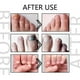 thumbnail image 4 of Onycholysis Nail Treatment & Strengthener, Onycholysis Nail Growth Conditioner, Onycholysis Heal & Restore Nails, Strengthen Weak Nails, 4 of 5