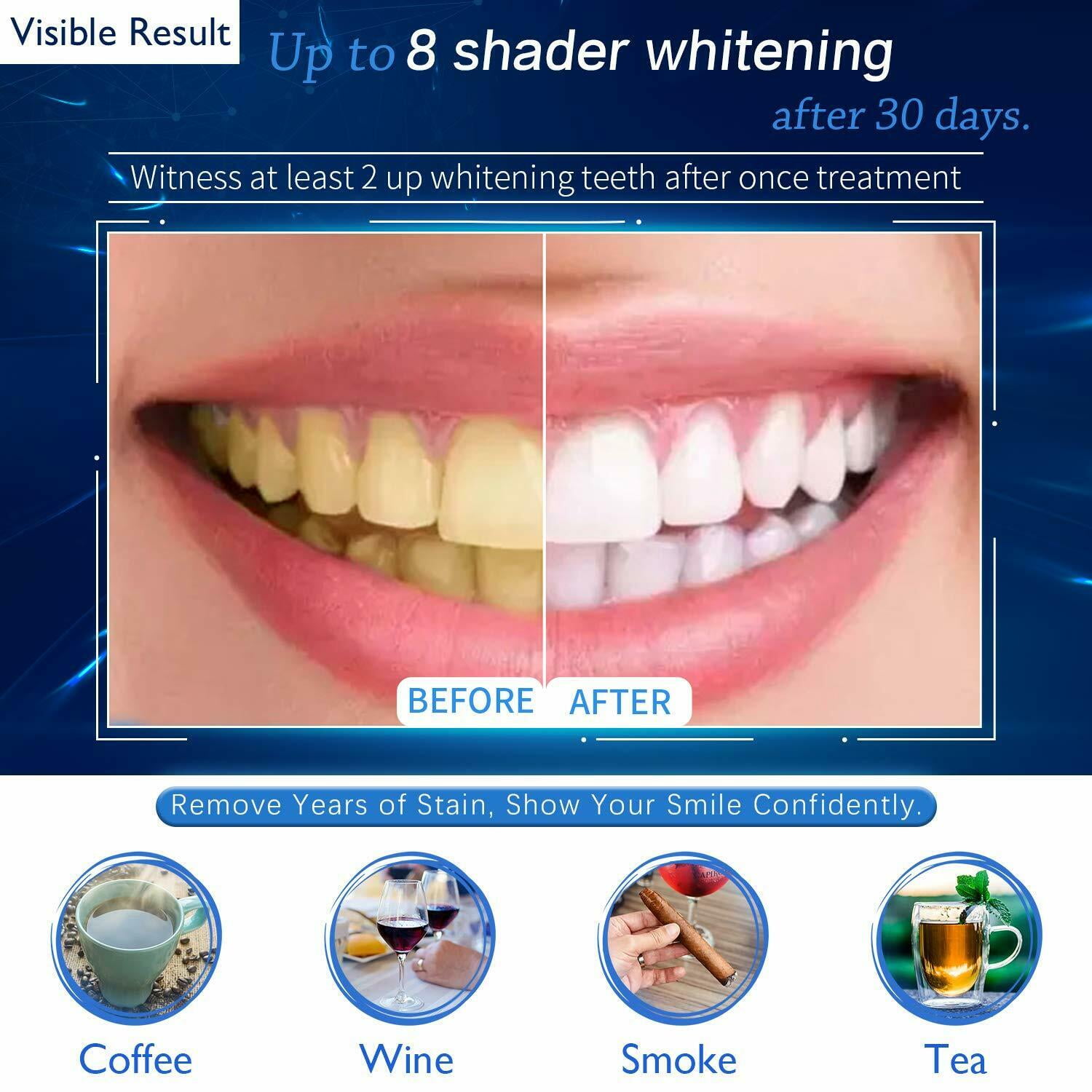 EZGO Teeth Whitening Gel Refills, 10 x 3ml Gyringes Carbamide Peroxide Tooth Bleaching Gel for Teeth Whitening Kit, No Sensitive Teeth Whitener, Dental Clinic Grade