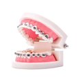 thumbnail image 1 of Ygjytge Modelo De Dientes De Ortodoncia Dental, Modelo De Enseñanza De Dentista, Herramientas De Ortodoncia Ygjytge Para estrenar, 1 of 8