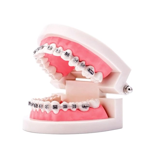 Ygjytge Modelo De Dientes De Ortodoncia Dental, Modelo De Enseñanza De Dentista, Herramientas De Ortodoncia Ygjytge Para estrenar