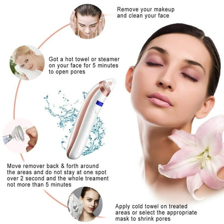 Isabell Blackhead Remover Spring Bud USB Rechargeable Blackhead Vacuum Suction Extractor Pore Cleanser with 4 Probes Acne Eliminator Microdermabrasion (Best At Home Microdermabrasion Device)