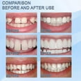 thumbnail image 3 of 30ml Faux Dents Moulables Particules Blanches Réutilisables Non Toxiques Remplissage Temporaire Regain Sourire, 3 of 5