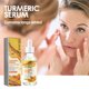 thumbnail image 4 of Fiudx Liquidación De Ahorros De Verano Suero Corrector Oscuro De Cúrcuma 2024, Nuevo Suero Facial Reparador De Cúrcuma, Suero Facial Corrector Oscuro De Piel Brillante, 30Ml, 4 of 6