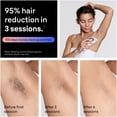 thumbnail image 4 of Braun Skin i-Expert Smart IPL PL7243 at Home Laser Hair Removal for Women and Men with App, Premium Pouch, 3 heads, Venus Razor, 4 of 20