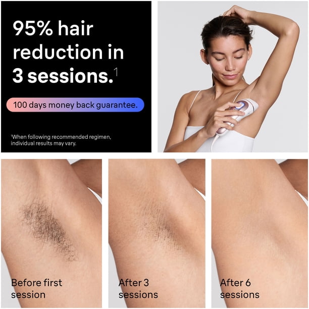 Braun Skin i-Expert Smart IPL PL7243 at Home Laser Hair Removal