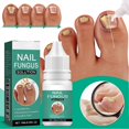 thumbnail image 2 of Anti Nail-Fungus Liquid for Grey Nails Uneven Colors Nail, Quick Absorption Nail Strengthening Cream, Nails Care Supplies, 2 of 5