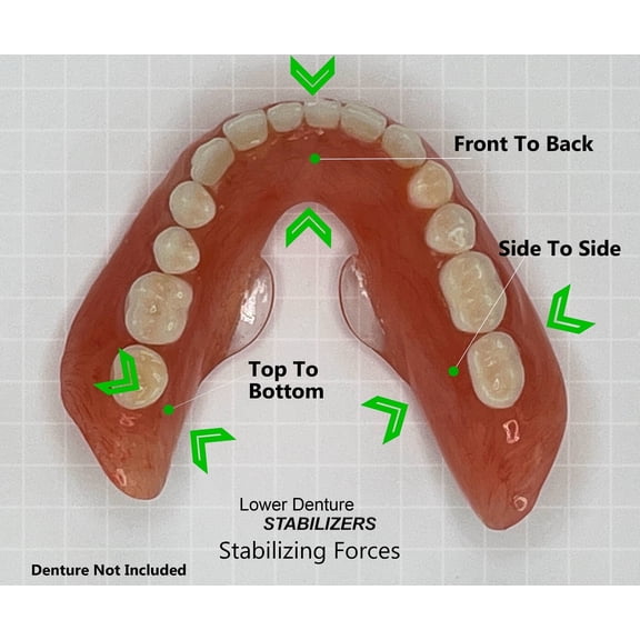 Stabil-Dent Do-It-Yourself Lower Denture Stabilizer Kit, Clear, DIY Kit