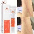 thumbnail image 1 of Crema de ácido salicílico para el acné, elimina las espinillas, Control de aceite, tratamiento antiacné, reparación de granos, acné, cicatriz, cuidado de la piel"face serum" Fivean LED, 1 of 2