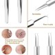 thumbnail image 5 of 2 piezas de herramienta para quitar puntos negros, extractor de comedones, pinzas para eliminar el acné, herramienta de maquillaje de acero inoxidable de 8,7 cm, 5 of 7