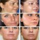 thumbnail image 2 of Crema hidratante para pecas, crema blanqueadora con vitamina C, iluminadora antienvejecimiento, elimina el Melasma facial, manchas oscuras, melanina, belleza, cuidado de la piel"snail cream" Fivean LED, 2 of 2