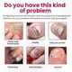 thumbnail image 3 of Ginger Infusion Nail Repair - Fortifies Toenails and Restores Smoothness for Optimal Nail Health, 3 of 5