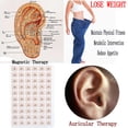 thumbnail image 1 of PVCS 300pcs Magnetic Therapy Ear Patch Auricular Auriculotherapy Acupuncture Seed, 1 of 8