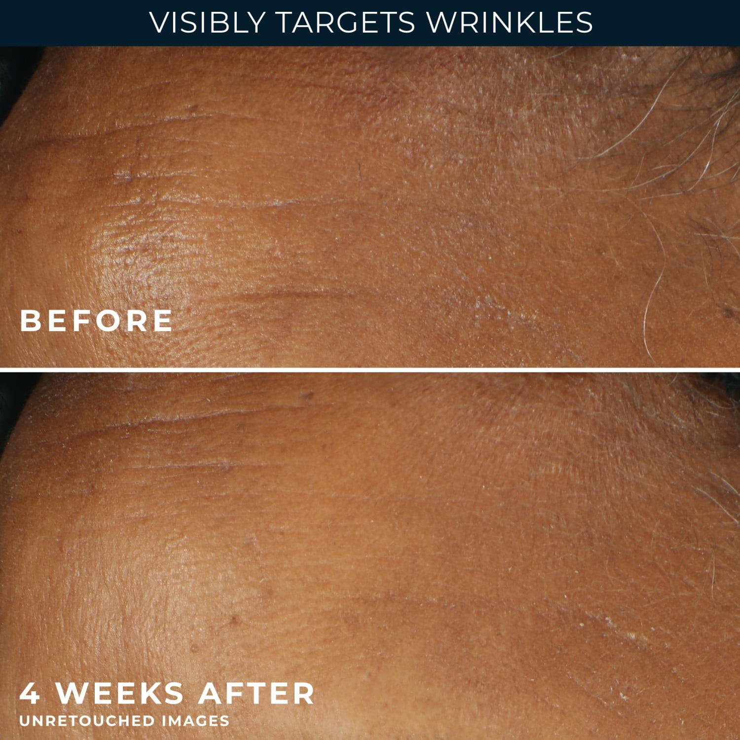 RoC Retinol Correxion Deep Wrinkle Face Moisturizer with SPF 30, for Fine Lines, Dark Spots, 1oz