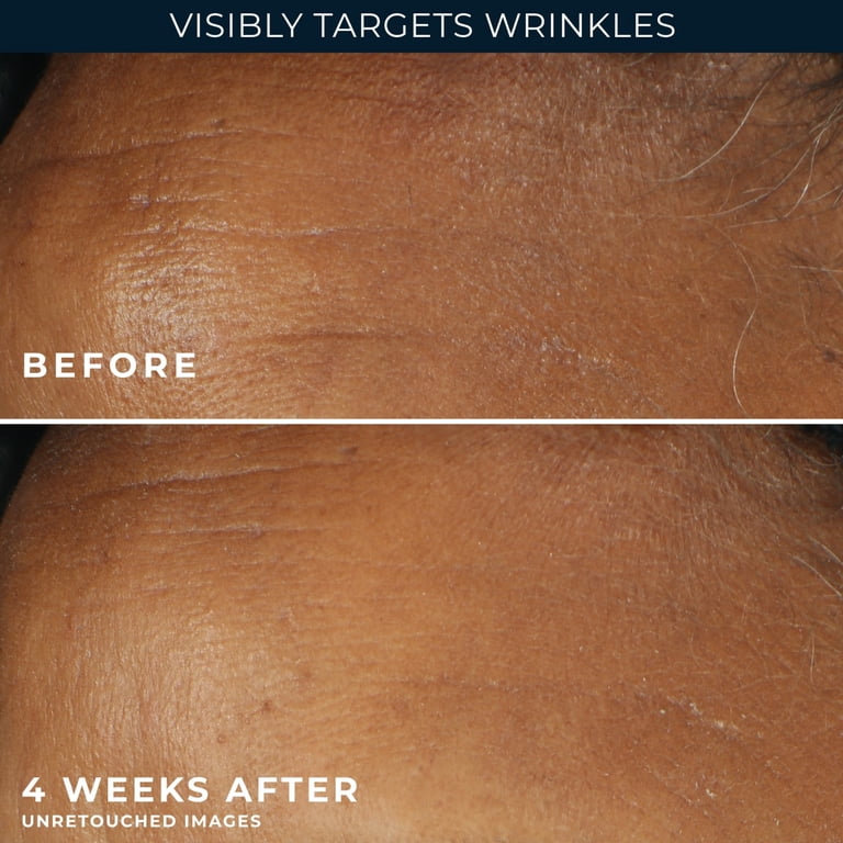 RoC Retinol Correxion Deep Wrinkle Moisturizer SPF 30, 1 oz photo 6