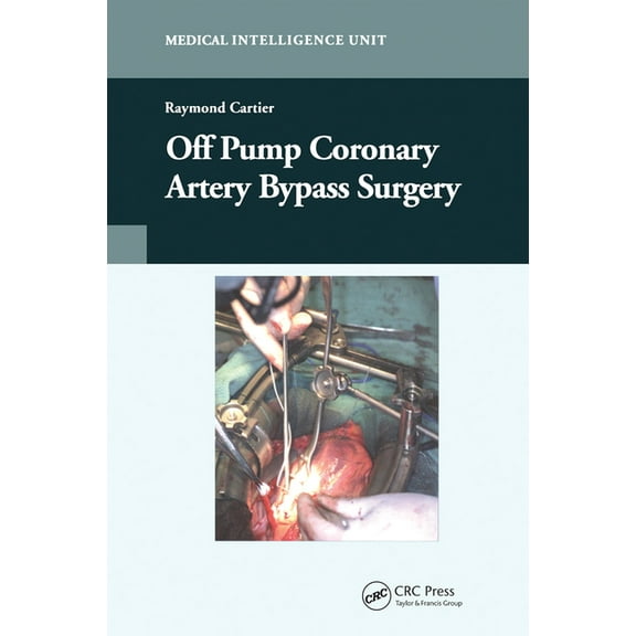 Off-Pump Coronary Artery Bypass Surgery, (Paperback)