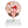 thumbnail image 2 of AMLESO Advanced Human Brain Cortex Pathology Model Anatomical Education Lab Display, 2 of 8