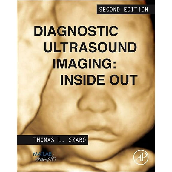 Biomedical Engineering Diagnostic Ultrasound Imaging: Inside Out, (Hardcover)