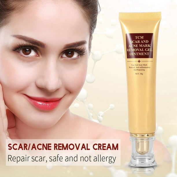 Cream Facial Cream Scar Removal Cream 30g Scar Mark Pimple Removal ...