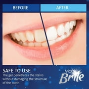 MagicBrite Complete Teeth Whitening Kit 2 Carbamide Peroxide Whitening Gel Pens with 1 LED Light At Home Whitening