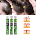 thumbnail image 1 of de esencia para el del cabello, antipérdida de cabello a base de hierbas para prevenir la pérdida de cabello posparto para - 3 piezas Colco Aerosol de hierbas, 1 of 6