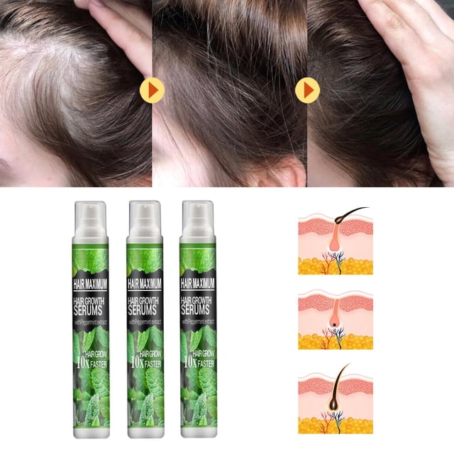 de esencia para el del cabello, antipérdida de cabello a base de hierbas para prevenir la pérdida de cabello posparto para - 3 piezas Colco Aerosol de hierbas