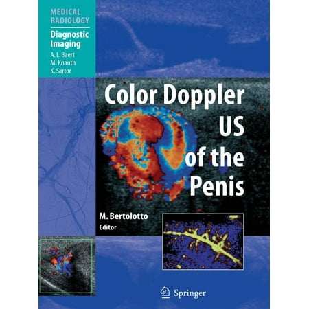 UPC: 9783642071751 | Color Doppler Us of the Penis (Paperback)
