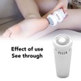 thumbnail image 4 of Foot Vacuum Callus Remover, Portable Vacuum Electric Foot Callus Remover  for Dead Skin, 4 of 8
