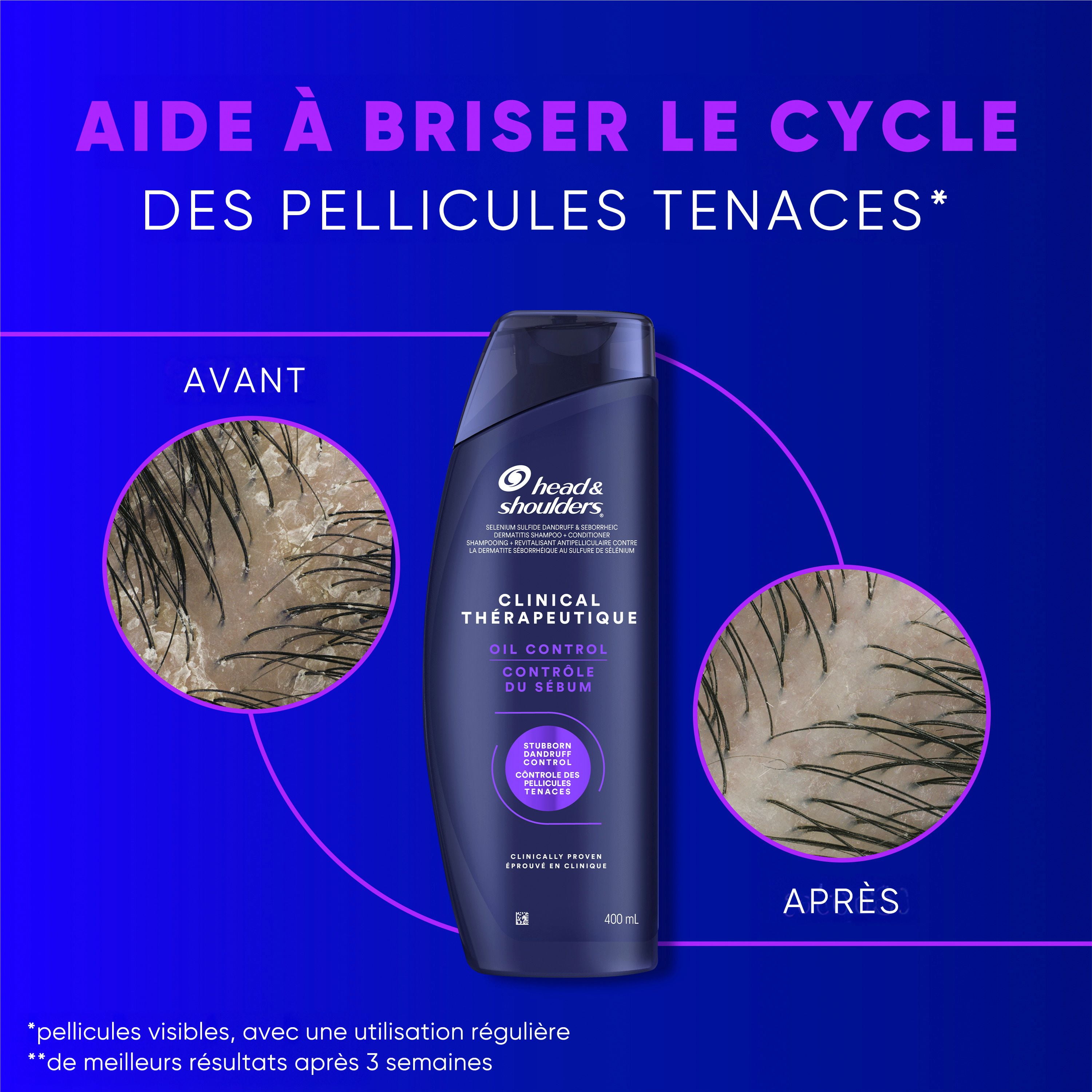 Head & Shoulders Défense Clinique contre les Pellicules + Shampooing Avancé de Contrôle du Sébum 400 ml