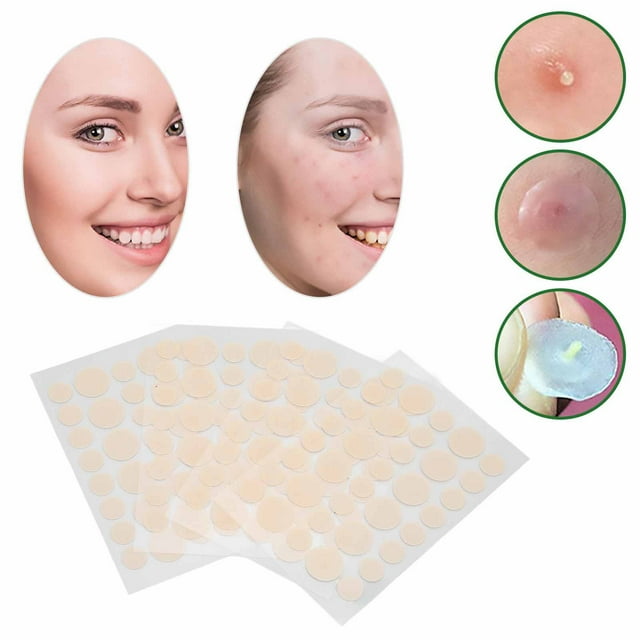 Patch de Acné, Reparacia de la Piel Patch Portátil de Granos para Vieges Domémicos para Hombres Mujeres