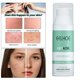 thumbnail image 4 of Crema antiacné, , tratamiento suave para el acné, reducción de , eliminación de espinillas, atención facial, blanqueamiento, inflamación, Yinane Eliminación, 4 of 8
